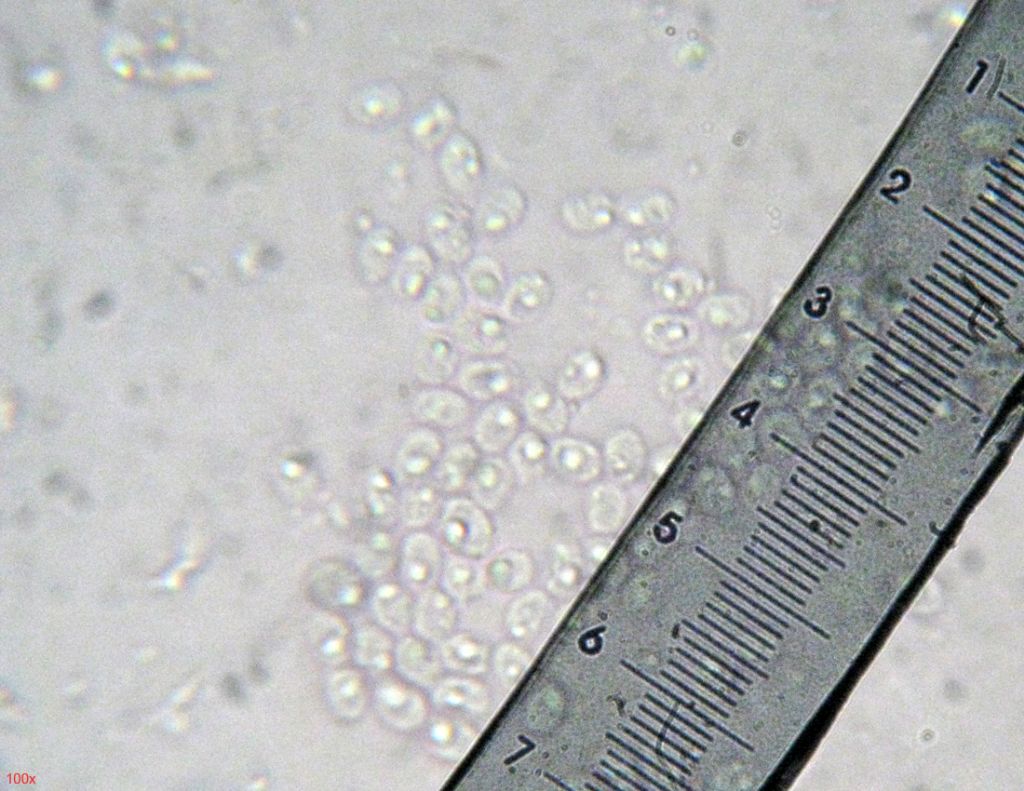 Steccherinum?